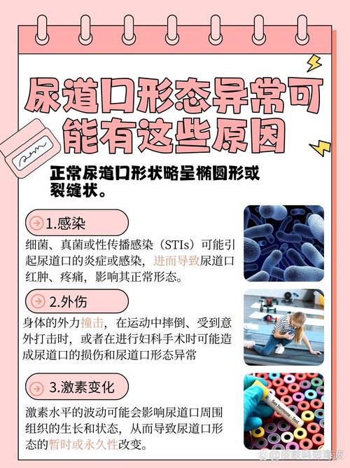 欧美熟妇adviose的相关介绍